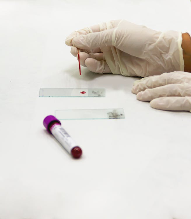 Blood Tests Every Bodybuilder Should Get: A Complete Health Guide — Au-Roids Guide